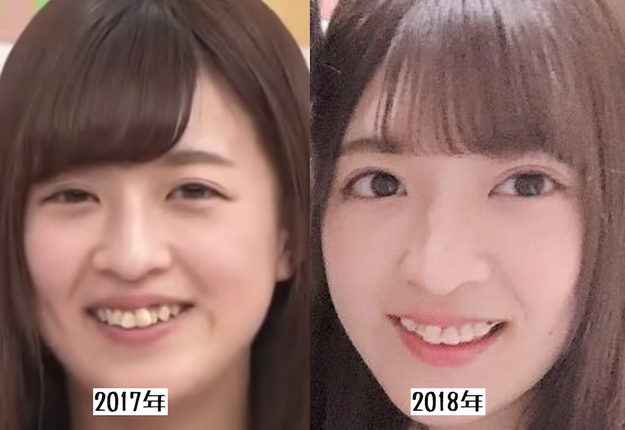 f:id:yorimichi_ticket:20180708100642p:plain f:id:yorimichi_ticket:20180708100642p:plain